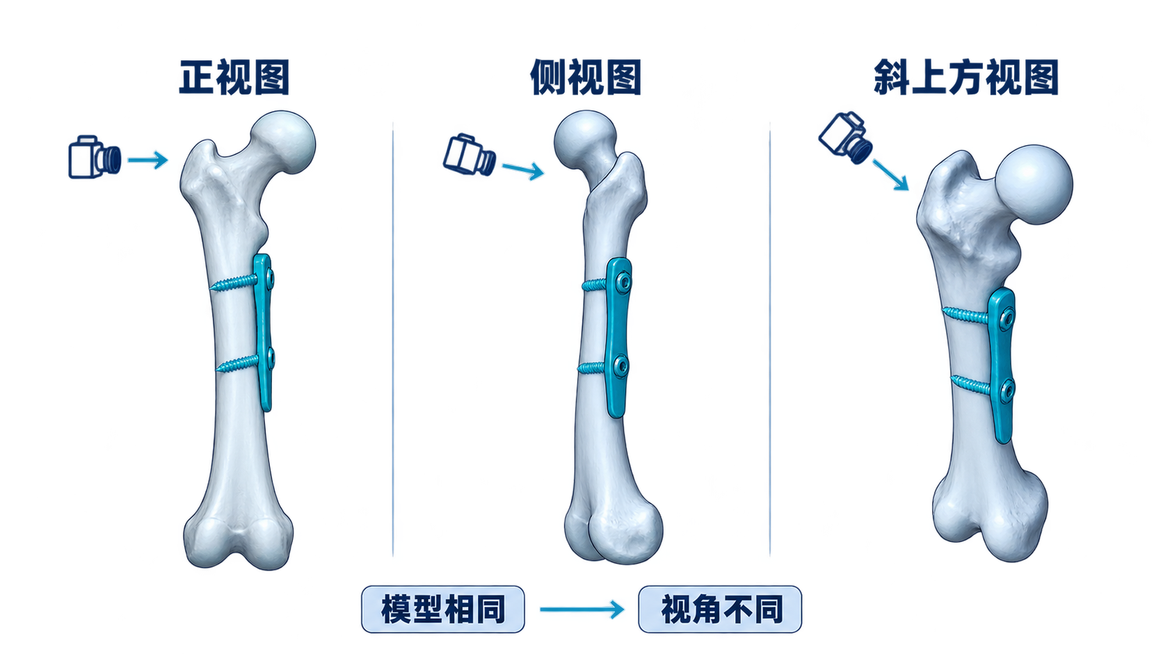 同一三维医学模型的不同观察视角